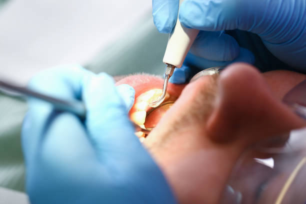 Best Emergency Dental Care for Trauma or Injury in Versailles, KY