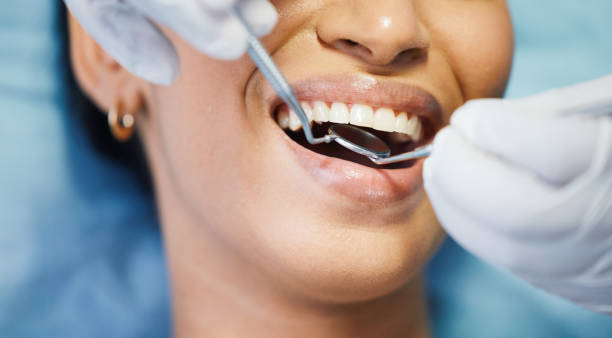 Best Emergency Treatment for Toothache in Versailles, KY