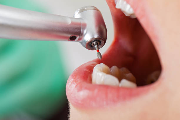 Best Emergency Treatment for Toothache in Versailles, KY